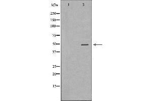 Western blot analysis of extracts from Hela  using KRT20 Antibody. (KRT20 Antikörper  (C-Term))
