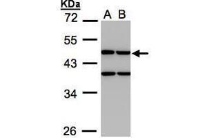 WB Image Sample(30 ug whole cell lysate) A:H1299 B:HeLa S3, 10% SDS PAGE antibody diluted at 1:1000 (CKMT1B Antikörper)