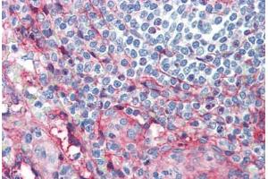 Human Spleen (formalin-fixed, paraffin-embedded) stained with ICAM1 antibody ABIN462119 followed by biotinylated anti-mouse IgG secondary antibody ABIN481714, alkaline phosphatase-streptavidin and chromogen. (ICAM1 Antikörper)