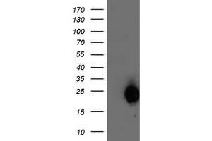 Western Blotting (WB) image for anti-ADP-Ribosylation Factor-Like 11 (ARL11) antibody (ABIN1496714)