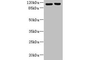 Western blot All lanes: RPGR antibody at 6 μg/mL Lane 1: 293T whole cell lysate Lane 2: Hela whole cell lysate Secondary Goat polyclonal to rabbit IgG at 1/10000 dilution Predicted band size: 114, 91, 71, 84, 53, 128 kDa Observed band size: 114 kDa (RPGR Antikörper  (AA 1-180))