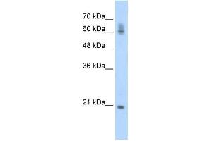 FIP1L1 antibody used at 0.