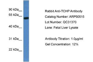 WB Suggested Anti-TCHP  Antibody Titration: 0. (TCHP Antikörper  (C-Term))