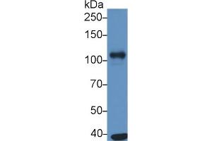 Detection of ATP1a1 in Human A549 cell lysate using Monoclonal Antibody to ATPase, Na+/K+ Transporting Alpha 1 Polypeptide (ATP1a1)