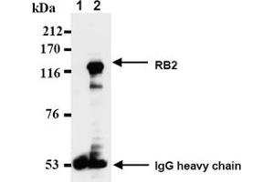 Western Blotting (WB) image for anti-Retinoblastoma-Like 2 (p130) (RBL2) antibody (ABIN487489) (p130 Antikörper)