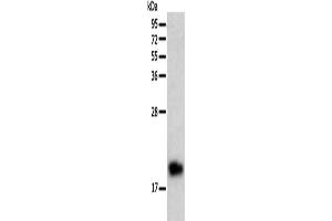 Gel: 12 % SDS-PAGE, Lysate: 40 μg, Lane: Human liver cancer tissue, Primary antibody: ABIN7128688(BTG2 Antibody) at dilution 1/200, Secondary antibody: Goat anti rabbit IgG at 1/8000 dilution, Exposure time: 10 minutes (BTG2 Antikörper)