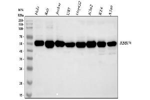 Western blot analysis of RbAp48 using anti-RbAp48 antibody (ABIN3043920). (Retinoblastoma Binding Protein 4 Antikörper  (C-Term))