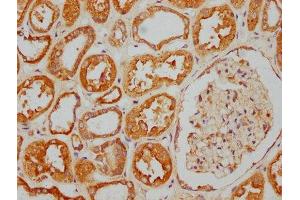 IHC image of ABIN7157690 diluted at 1:400 and staining in paraffin-embedded human kidney tissue performed on a Leica BondTM system. (KANK2 Antikörper  (AA 410-585))
