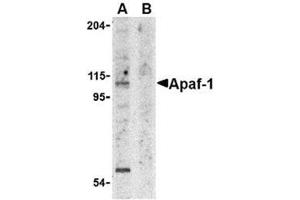Image no. 2 for anti-Apoptotic Peptidase Activating Factor 1 (APAF1) (AA 12-28) antibody (ABIN319002) (APAF1 Antikörper  (AA 12-28))