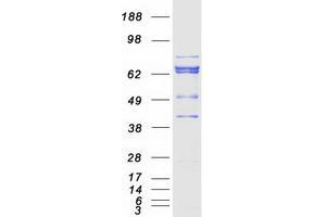 Validation with Western Blot (PKC beta Protein (Transcript Variant 2) (Myc-DYKDDDDK Tag))