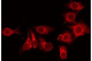 ABIN6275804 staining HuvEc by IF/ICC. (TMEM101 Antikörper  (Internal Region))