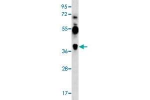 Western blot analysis of K-562 cell lysate (35 ug/lane) with MAGEA12 polyclonal antibody . (MAGEA12 Antikörper  (N-Term))