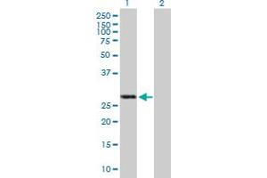 Western Blot analysis of IFIH1 expression in transfected 293T cell line by IFIH1 MaxPab polyclonal antibody. (IFIH1 Antikörper  (AA 1-221))