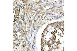 Immunohistochemistry (IHC) image for anti-Tumor Necrosis Factor, alpha-Induced Protein 3 (TNFAIP3) (AA 1-190) antibody (ABIN3022985)