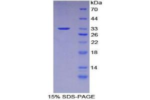 SDS-PAGE analysis of Mouse CFLAR Protein.