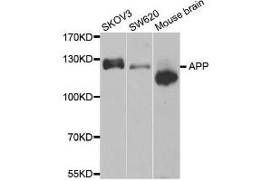 Western blot analysis of extracts of various cell lines, using APP antibody. (APP Antikörper)