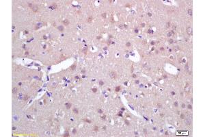 Formalin-fixed and paraffin embedded rat brain labeled with Rabbit Anti SPAG5/MAP126/Astrin Polyclonal Antibody, Unconjugated (ABIN672261) at 1:200 followed by conjugation to the secondary antibody and DAB staining
