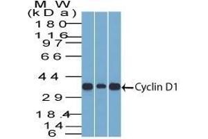 Western Blot Analysis of Cyclin D1 (1) C2C12, (2) HepG2, & (3) NIH3T3 cell lysate Cyclin D1 Mouse Monoclonal Antibody (DCS-6). (Cyclin D1 Antikörper)