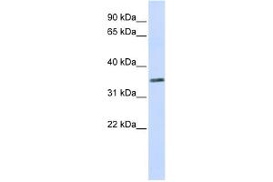 WB Suggested Anti-C2orf60 Antibody Titration:  0. (C2orf60 Antikörper  (Middle Region))