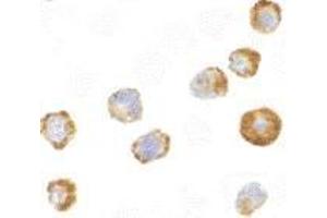 Immunocytochemistry of ASK1 in A431 cells with AP30086PU-N ASK1 antibody at 2 μg/ml. (ASK1 Antikörper)