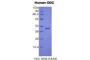SDS-PAGE (SDS) image for Ornithine Decarboxylase 1 (ODC1) (AA 15-259) protein (His tag) (ABIN1171069)