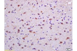 Formalin-fixed and paraffin embedded rat brain labeled with Rabbit Anti phospho-PKC delta (Tyr311) Polyclonal Antibody, Unconjugated (ABIN703270) at 1:200 followed by conjugation to the secondary antibody and DAB staining (PKC delta Antikörper  (pTyr313))