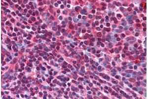 Human Tonsil (formalin-fixed, paraffin-embedded) stained with CD5L antibody ABIN214596 at 5 ug/ml followed by biotinylated goat anti-rabbit IgG secondary antibody ABIN481713, alkaline phosphatase-streptavidin and chromogen. (CD5L Antikörper  (N-Term))