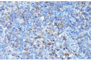 Immunohistochemistry of paraffin-embedded Mouse spleen using CXCR1 Polyclonal Antibody at dilution of 1:100 (40x lens). (CXCR1 Antikörper)
