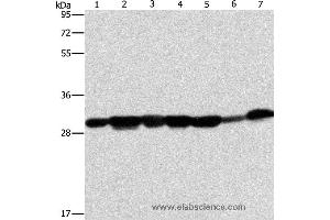 Western blot analysis of Human placenta tissue and A549 cell, mouse brain tissue and hepG2 cell, Raji cell and human fetal liver tissue, hela cell, using AK2 Polyclonal Antibody at dilution of 1:300 (Adenylate Kinase 2 Antikörper)