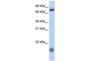 Image no. 1 for anti-Leber Congenital Amaurosis 5-Like (LCA5L) (N-Term) antibody (ABIN6740944) (LCA5L Antikörper  (N-Term))