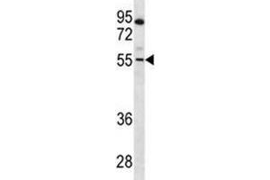 PAX7 antibody western blot analysis in CEM lysate (PAX7 Antikörper  (AA 181-210))