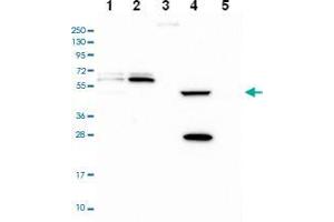 Western blot analysis of Lane 1: RT-4 Lane 2: U-251 MG Lane 3: Human Plasma Lane 4: Liver Lane 5: Tonsil with PPAN-P2RY11 polyclonal antibody . (PPAN Antikörper)