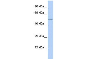 WB Suggested Anti-B4GALT3 Antibody Titration:  0.