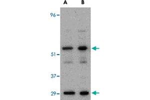 Western blot analysis of PDCD4 in A-20 cell lysate with PDCD4 polyclonal antibody  at (A) 0. (PDCD4 Antikörper  (C-Term))