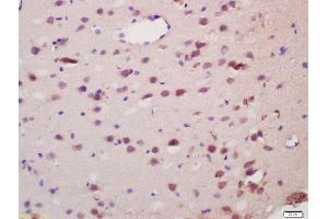 Formalin-fixed and paraffin embedded rat brain labeled with Anti-Spinophilin/Neurabin 2 Polyclonal Antibody, Unconjugated (ABIN1386710) at 1:200 followed by conjugation to the secondary antibody and DAB staining (PPP1R9B Antikörper  (AA 358-460))