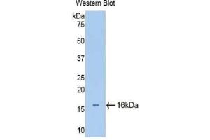 Detection of Recombinant AGC, Mouse using Polyclonal Antibody to Aggrecan (AGC) (Aggrecan Antikörper  (AA 34-147))