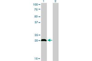 Western Blotting (WB) image for anti-Cbp/p300-Interacting Transactivator, with Glu/Asp-Rich Carboxy-terminal Domain, 1 (CITED1) (AA 94-193) antibody (ABIN561852)