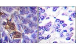 Immunohistochemistry analysis of paraffin-embedded human pancreas tissue, using MSK1 (Ab-360) Antibody. (MSK1 Antikörper  (AA 331-380))