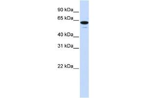 WB Suggested Anti-ZNF655 Antibody Titration:  0. (ZNF655 Antikörper  (Middle Region))