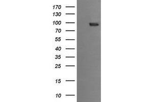 Image no. 1 for anti-Phosphoinositide-3-Kinase, Regulatory Subunit 5 (PIK3R5) antibody (ABIN1500218) (PIK3R5 Antikörper)