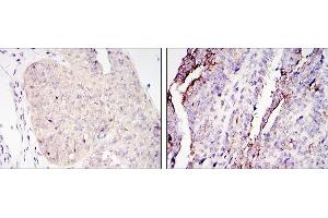 Immunohistochemistry (IHC) image for anti-CREB Regulated Transcription Coactivator 2 (CRTC2) antibody (ABIN969067)
