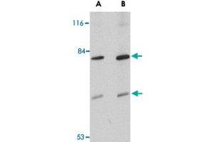 Western blot analysis of TMC8 in Jurkat cell lysate with TMC8 polyclonal antibody  at (A) 1 and (B) 2 ug/mL . (TMC8 Antikörper  (Internal Region))