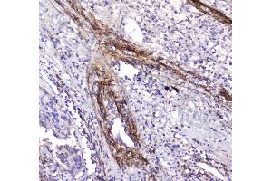 IHC analysis of Serum Amyloid P using anti-Serum Amyloid P antibody . (APCS Antikörper  (AA 20-220))