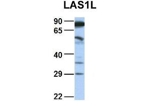 Western Blotting (WB) image for anti-LAS1-Like (LAS1L) (Middle Region) antibody (ABIN2775919)