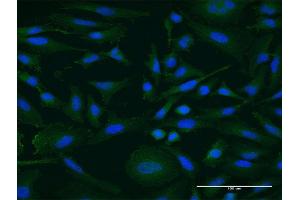 Immunofluorescence of monoclonal antibody to IGDCC4 on HeLa cell. (IGDCC4 Antikörper  (AA 1152-1250))