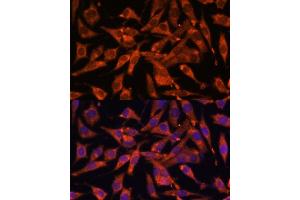 Immunofluorescence analysis of L929 cells using MT-ND1 Polyclonal Antibody (ABIN7268598) at dilution of 1:100 (40x lens). (MT-ND1 Antikörper)