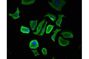 Immunofluorescence (IF) image for anti-Coiled-Coil Domain Containing 6 (CCDC6) (AA 347-440) antibody (ABIN7148132)