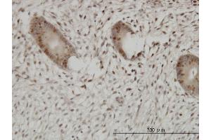 Immunoperoxidase of monoclonal antibody to UHRF1 on formalin-fixed paraffin-embedded human endometrium. (UHRF1 Antikörper  (AA 694-793))