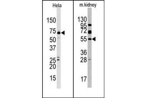 Image no. 1 for anti-Jumonji Domain Containing 4 (JMJD4) (C-Term) antibody (ABIN356562) (JMJD4 Antikörper  (C-Term))