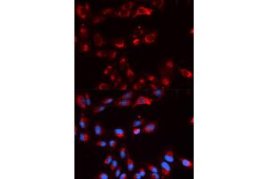 Immunofluorescence analysis of U2OS cells using CFP antibody (ABIN5973127). (CFP Antikörper)